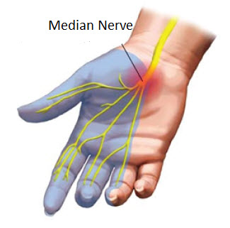 Peripheral Nerve Surgery Centre in Hyderabad